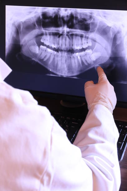 Best Emergency Root Canal Treatment in Brentwood, CA