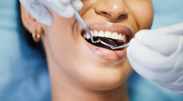 Best Cosmetic Emergency Dentistry in Brentwood, CA